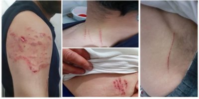 Amed: Polîsan ra pê kutikan îşkence!