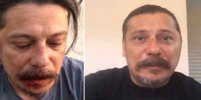 Rojnameger Acarer raştê hêrişî ame