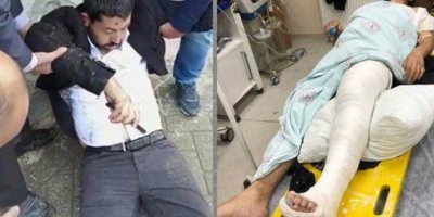 Soylu li ser wêneyê parlamenterê HDPê yê piyê wî şikestî çi got?