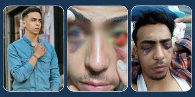 Parsa Qobadî yek ji serhildêrê şoreşa Jînayê ronahiya her du çavên xwe ji dest dan