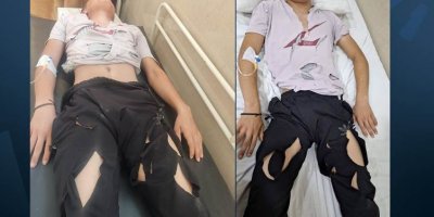 EFRÎN - Grûpên çekdar dîsa êrişî malbata Pêşmergan kir: Xortekî 15 salî birîndar e