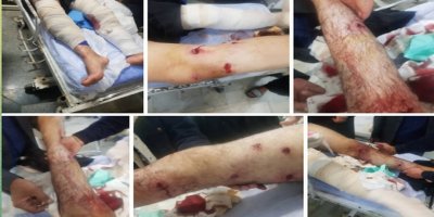 Hêzên tepeserkare rêjîmê li Kirmaşanê 2 ciwanên Kurd birîndar kirin