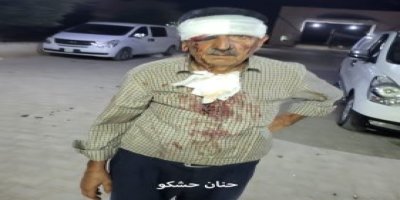 Efrîn di bin dagîrkeriyê de (329)