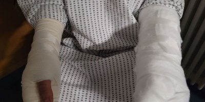 Li Almanyayê êrişa nijadperestî, ciwanekî Kurd hat birîndarkirin