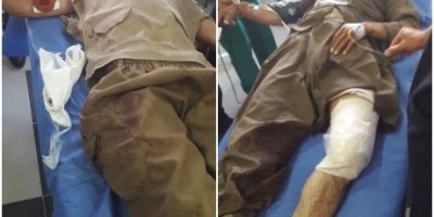 Hêzên Îranê 2 kolberên Kurd birîndar kirin