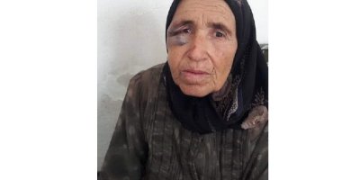 Efrîn De Dapîra 74 Serrî Bi Îşkence Amey Kiştene!